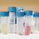 Test tubes with blue caps in a laboratory rack